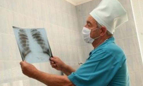 В Крыму не хватает врачей-фтизиатров
