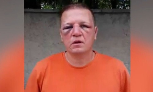 Полиция избила военного пенсионера из Севастополя